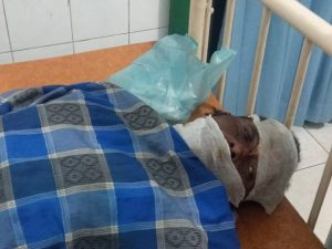 Kejam, Pria Lansia Dibakar Istri Muda