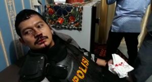 Update Demo Ricuh di DPRD Padangsidimpuan, Hingga Sore, Total Polisi Yang Terluka Empat dan 3 Mahasiswa