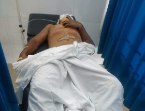 Dua Orang Pencuri Sepeda Motor Dihajar Massa, Satu Masuk Rumah Sakit