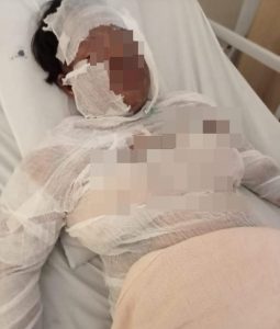 Tragis! Ketahuan Selingkuh, Suami Bakar Istri Hidup-hidup