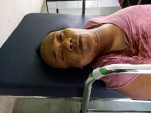 Heboh! Penumpang Taxi di Sidimpuan Tiba-Tiba Meninggal, Pakai Cincin Berlian