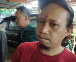 Ini Pengakuan Amin Nasution, Korban Tawuran Pelajar di Sidimpuan