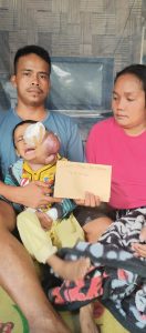 Radiapoh Tak Peduli, Mantan Bupati JR Saragih Bantu Biaya Pengobatan Balita Penderita Tumor Mata