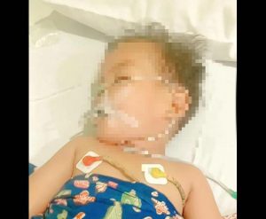 Wali Kota Irsan Jangan Diam Aja, Balita Asal Sidimpuan ini Tiga Hari Koma dan Butuh Biaya