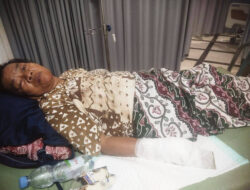 Tragis, Nenek di Karawang Kehilangan Empat Jari Akibat Lomba Tarik Tambang