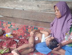 Miris! Orangtua Bocah Usus Keluar di Sidimpuan Tak Pernah Dapat PKH