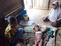 Lapor Pak Prabowo, Bocah Usus Keluar di Sidimpuan Tak Punya Biaya  Berobat