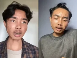 Viral! Penyakit Kulit Langka Menyerang Pria Usai Pakai Baju Bekas Tanpa Cuci