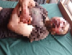 Dibogem! Aseng, Penjual Susu Kedelai Nyaris Tewas di Simarsayang Padangsidimpuan