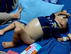 Kasihan!  Anak Tiga Tahun Asal WEK III Sidimpuan Terkena Tumor Perut