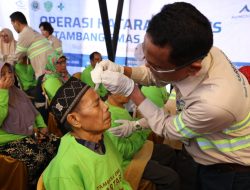 Hingga 2024, PT  Agincourt Resources Operasi 12 Ribu Penderita Katarak di Tabagsel
