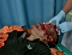 Tragis! Wajah, Kepala dan Tangan Pedagang Sate di Padanglawas Utara Dibacok OTK