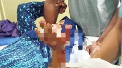 Toke Ikan di Sidimpuan Dirampok, Tangan Luka, Uang Puluhan Juta Raib