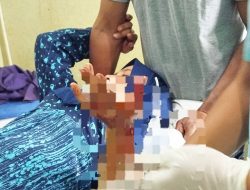 Toke Ikan di Sidimpuan Dirampok, Tangan Luka, Uang Puluhan Juta Raib